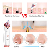 Ultrasonic Skin Scrubber - Facial Peeling Pore Cleaner Exfoliator