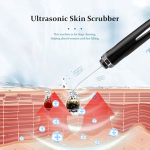 Ultrasonic Skin Scrubber - Facial Peeling Pore Cleaner Exfoliator